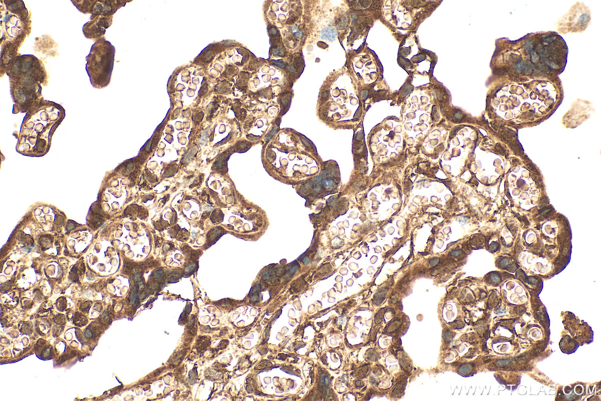 IHC staining of human placenta using 31712-1-AP