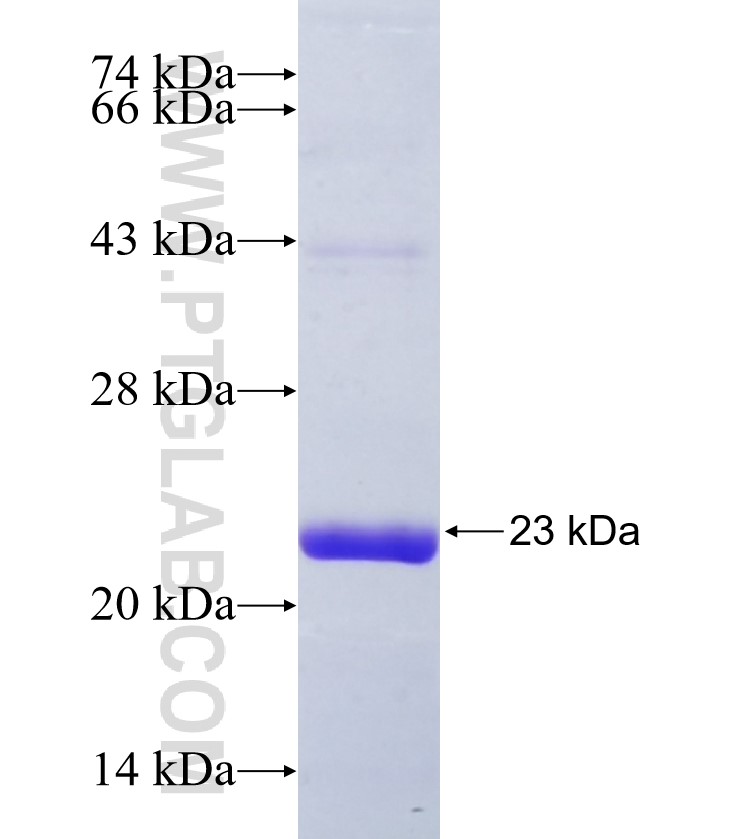 SHROOM4 fusion protein Ag36423 SDS-PAGE SHROOM4 fusion protein Ag36423 SDS-PAGE