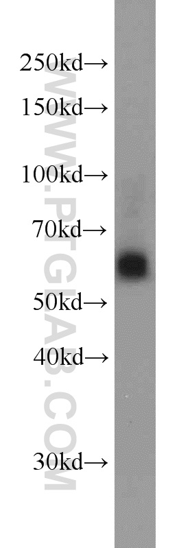 SIAH1 Polyclonal antibody