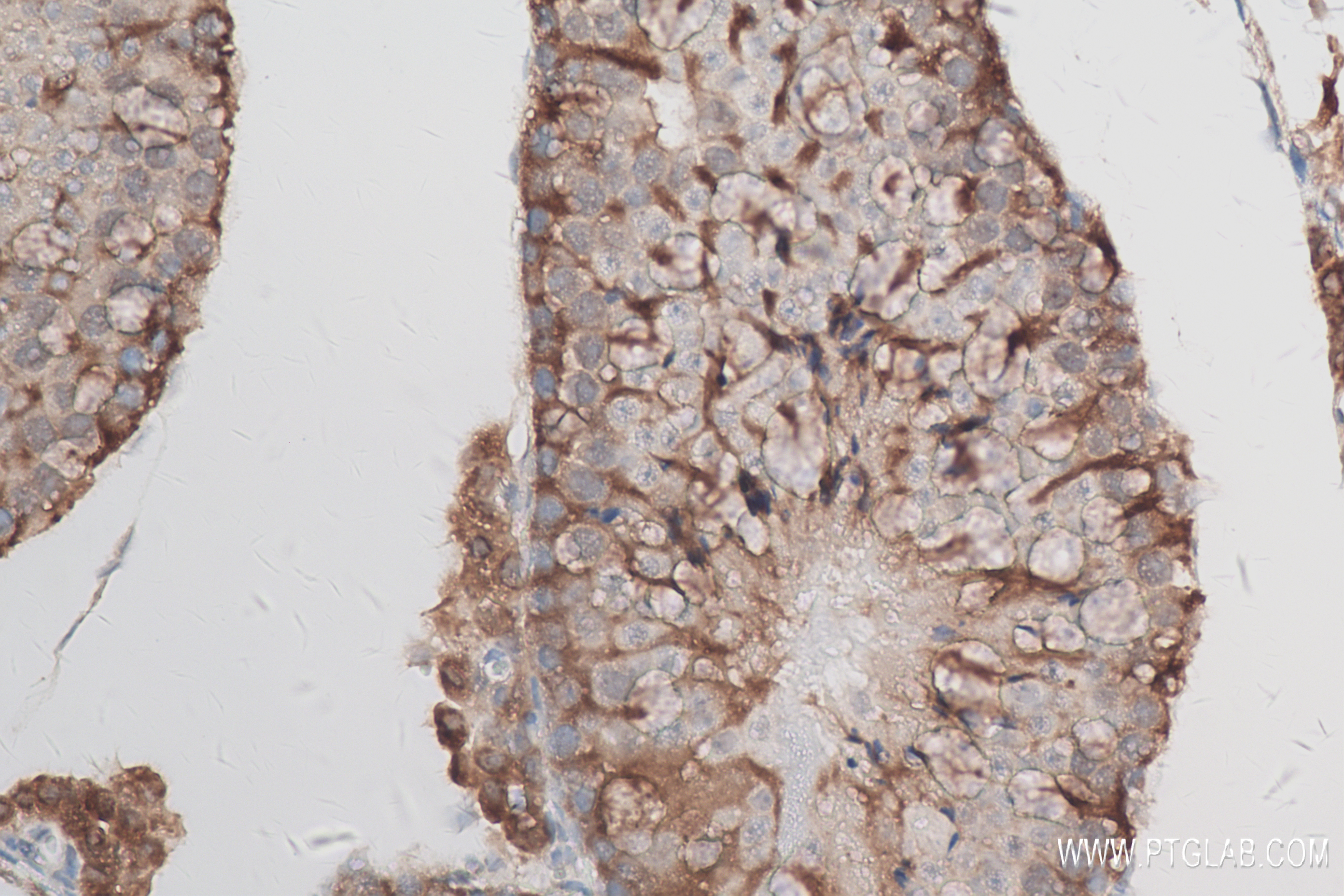 IHC staining of mouse testis using 83389-4-RR