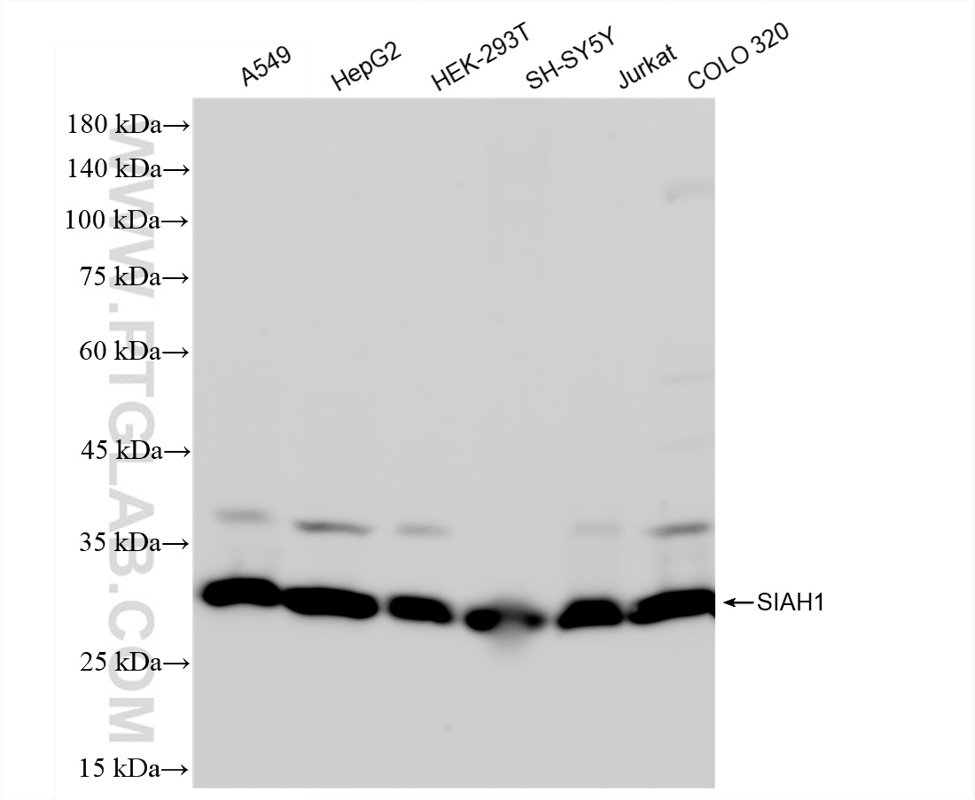 WB analysis using 83389-4-RR