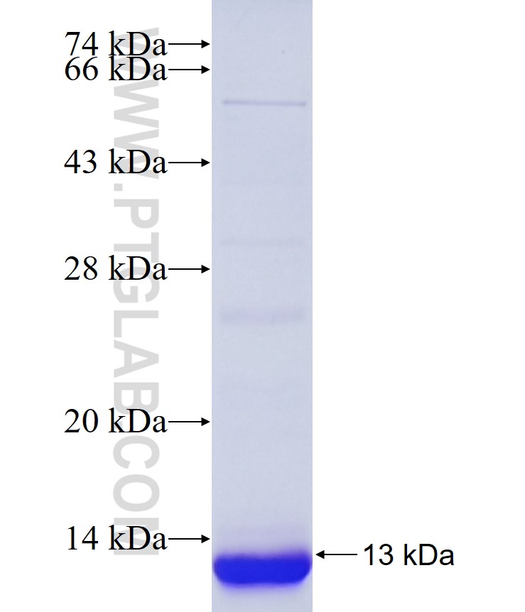 SIAH1 fusion protein Ag34187 SDS-PAGE