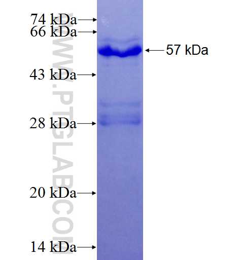 SIAH1 fusion protein Ag4336 SDS-PAGE
