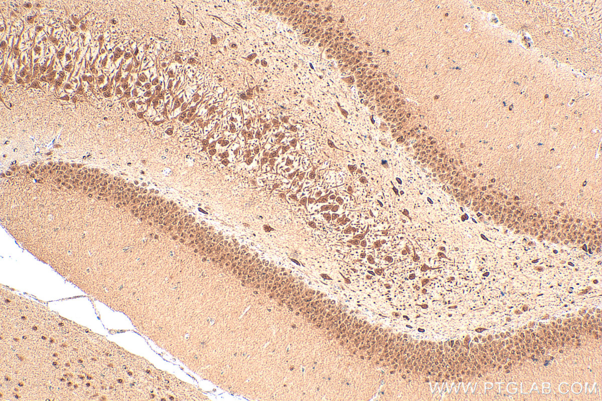 Immunohistochemical analysis of paraffin-embedded rat brain tissue slide using 12651-1-AP (SIAH2 antibody) at dilution of 1:100 (under 10x lens). Heat mediated antigen retrieval with Tris-EDTA buffer (pH 9.0). IHC staining of rat brain using 12651-1-AP