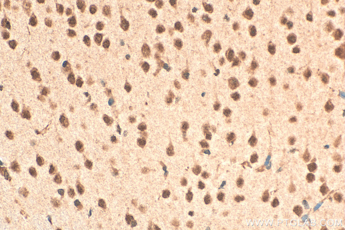 Immunohistochemical analysis of paraffin-embedded mouse brain tissue slide using 12651-1-AP (SIAH2 antibody) at dilution of 1:100 (under 40x lens). Heat mediated antigen retrieval with Tris-EDTA buffer (pH 9.0). IHC staining of mouse brain using 12651-1-AP