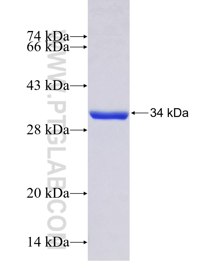 SIAH2 fusion protein Ag32820 SDS-PAGE