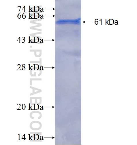 SIAH2 fusion protein Ag3342 SDS-PAGE