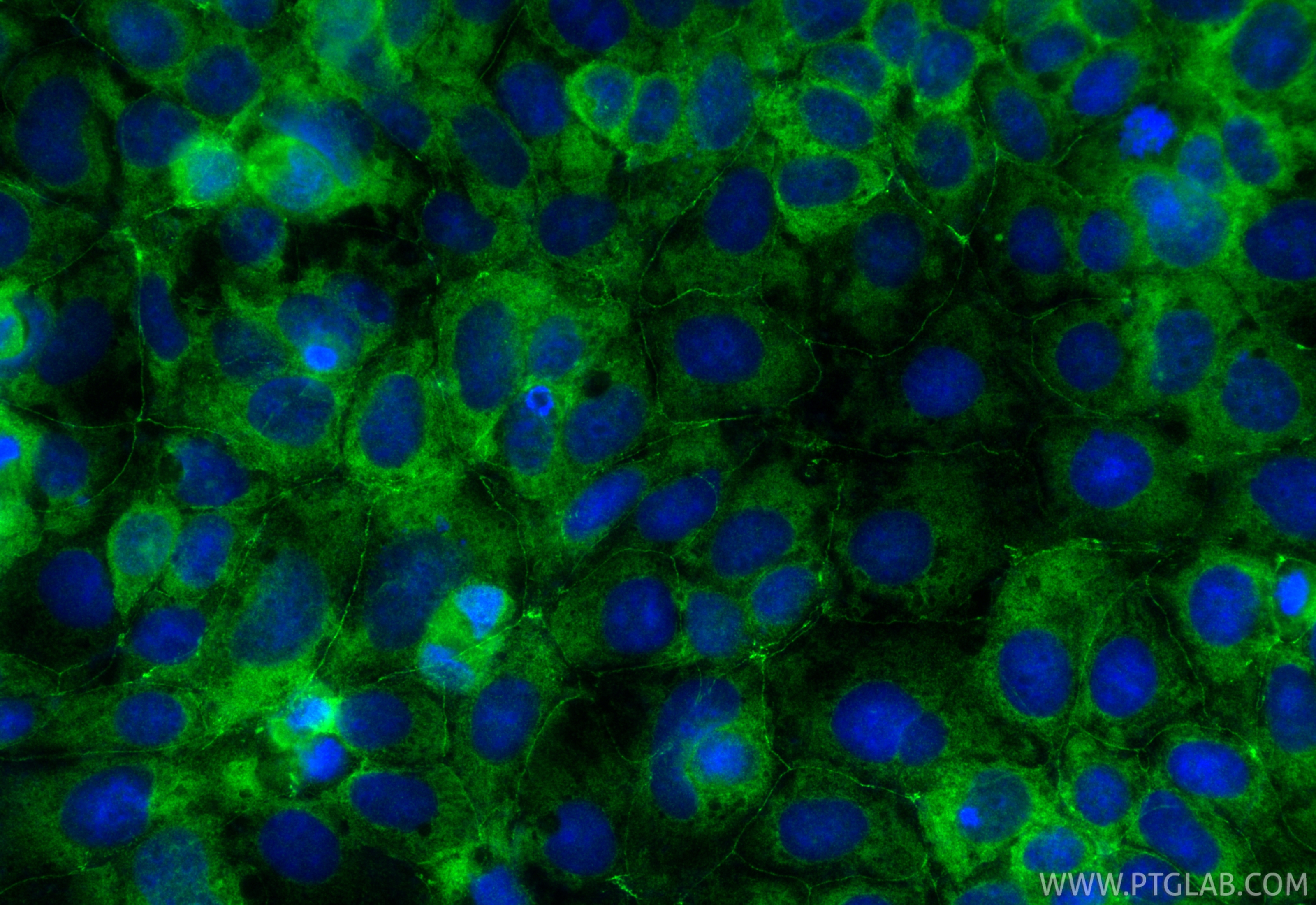 IF Staining of Caco-2 using 55352-1-AP (same clone as 55352-1-PBS) IF Staining of Caco-2 using 55352-1-AP (same clone as 55352-1-PBS)
