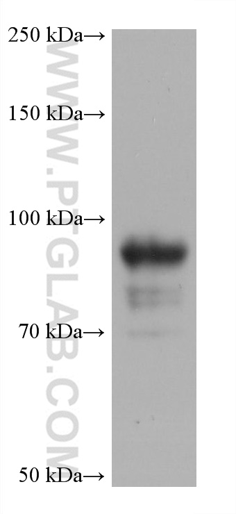 SIGLEC10