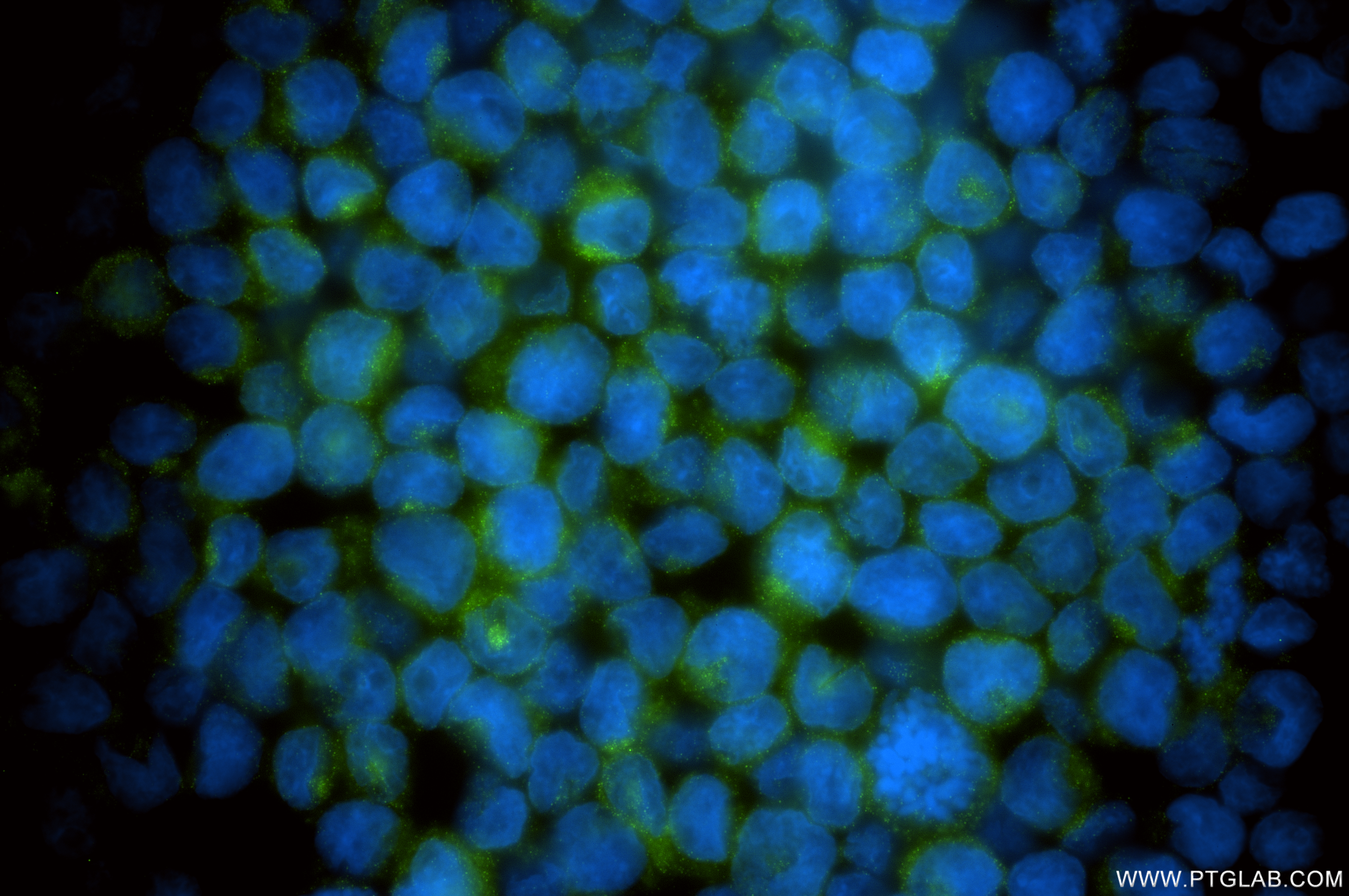IF Staining of U-937 using 86628-3-RR (same clone as 86628-3-PBS) IF Staining of U-937 using 86628-3-RR (same clone as 86628-3-PBS)