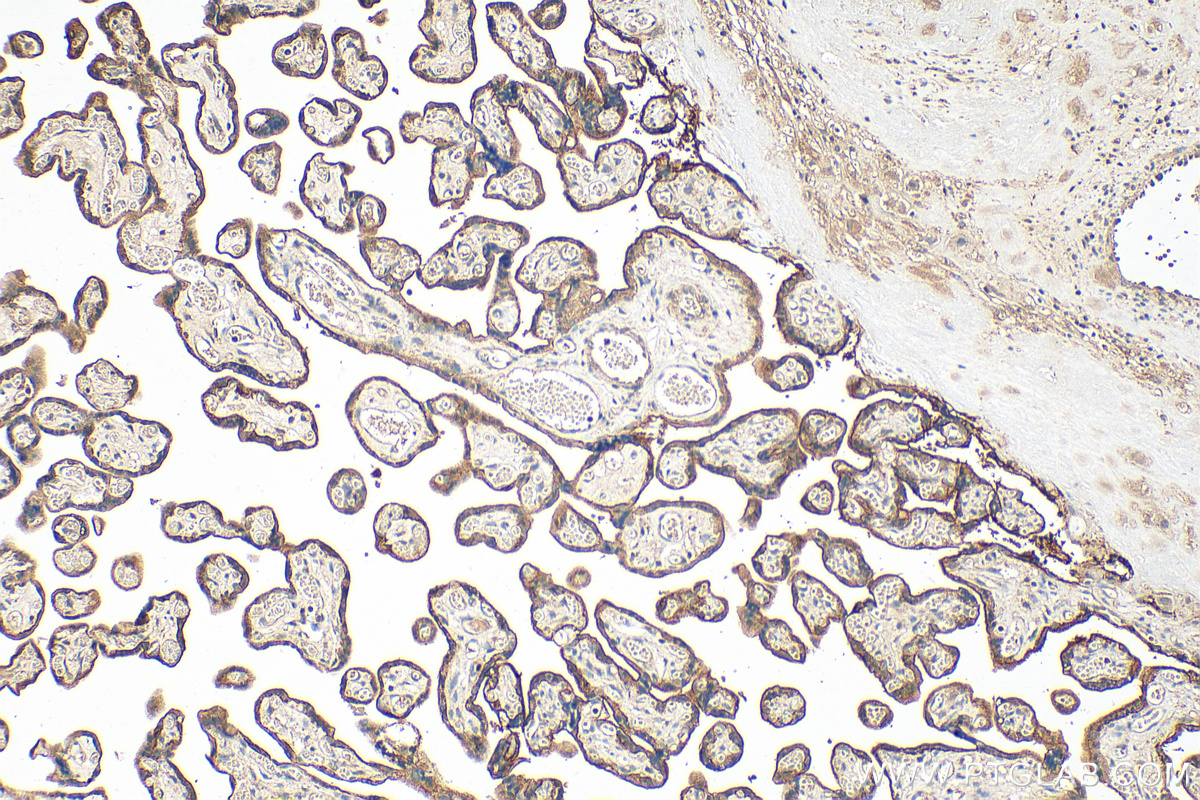 IHC staining of human placenta using 13454-1-AP