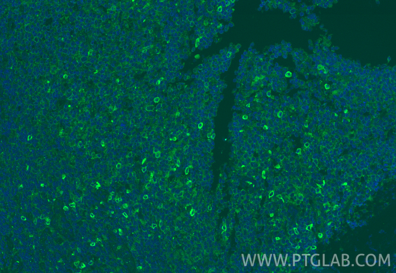 IF Staining of human tonsillitis using 13377-1-AP