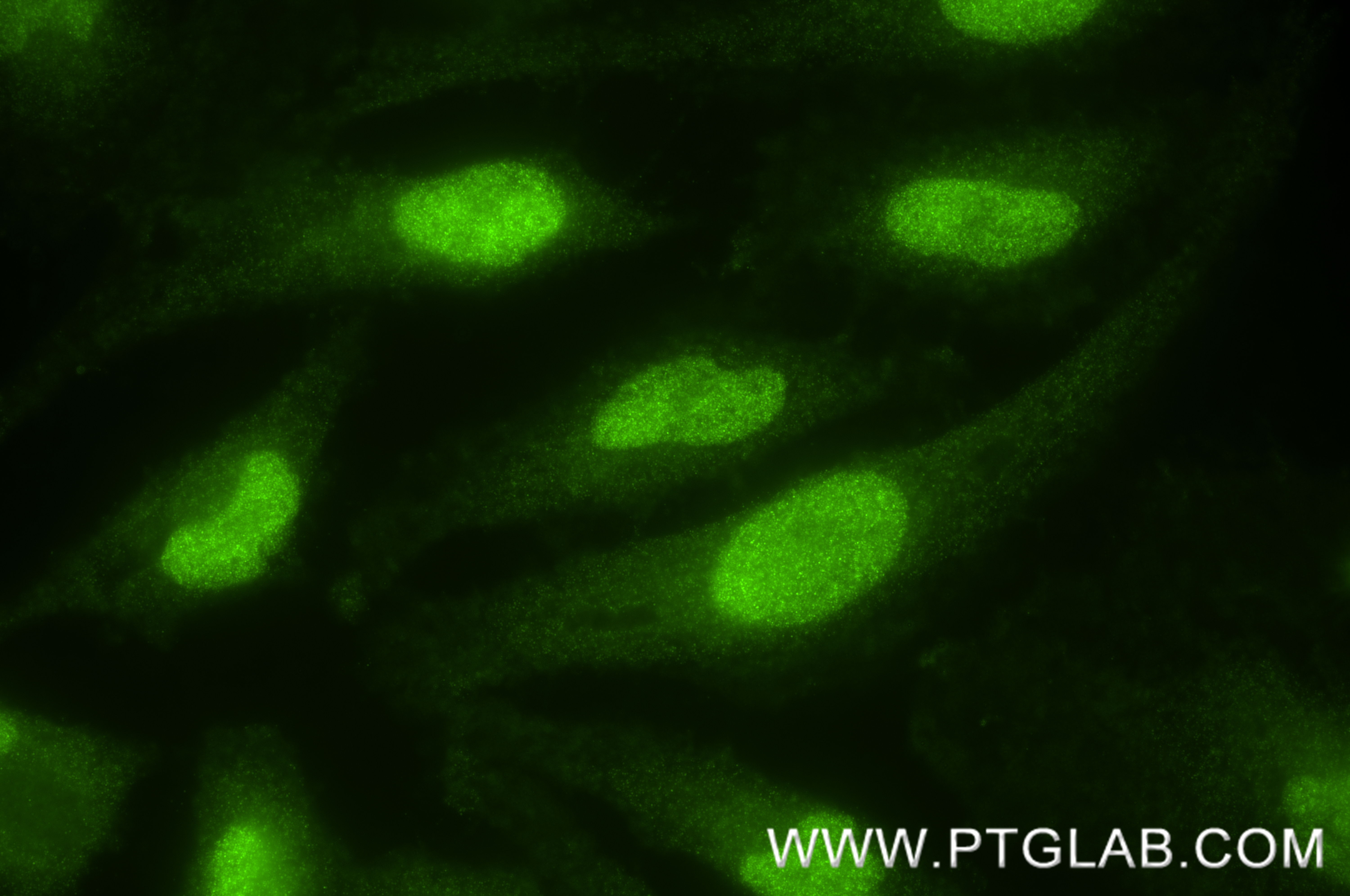 IF Staining of HeLa using 85064-1-RR (same clone as 85064-1-PBS) IF Staining of HeLa using 85064-1-RR (same clone as 85064-1-PBS)