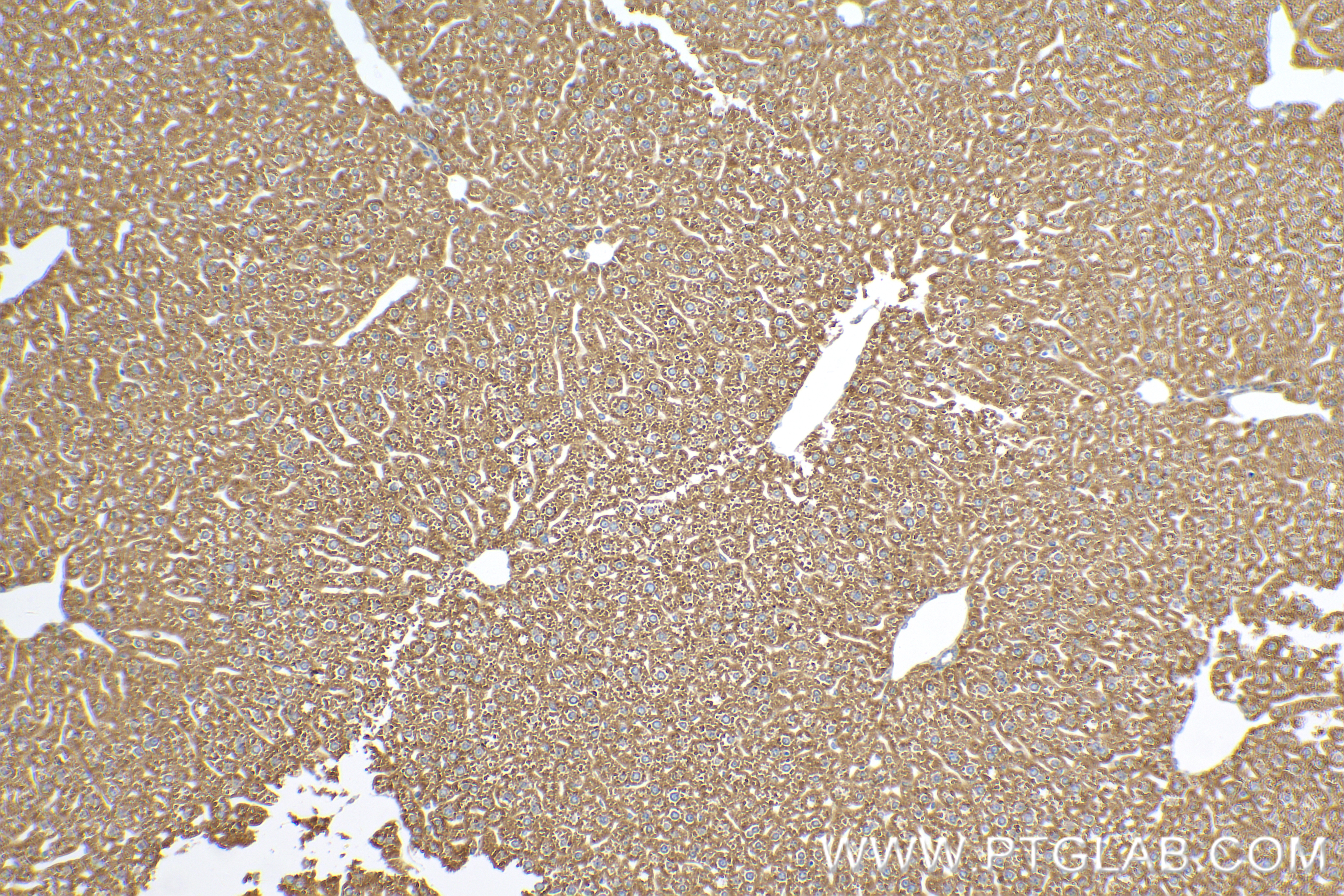 IHC staining of mouse liver using 85064-1-RR (same clone as 85064-1-PBS)