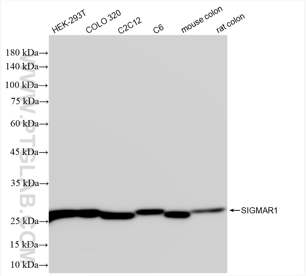 WB analysis using 85064-1-RR