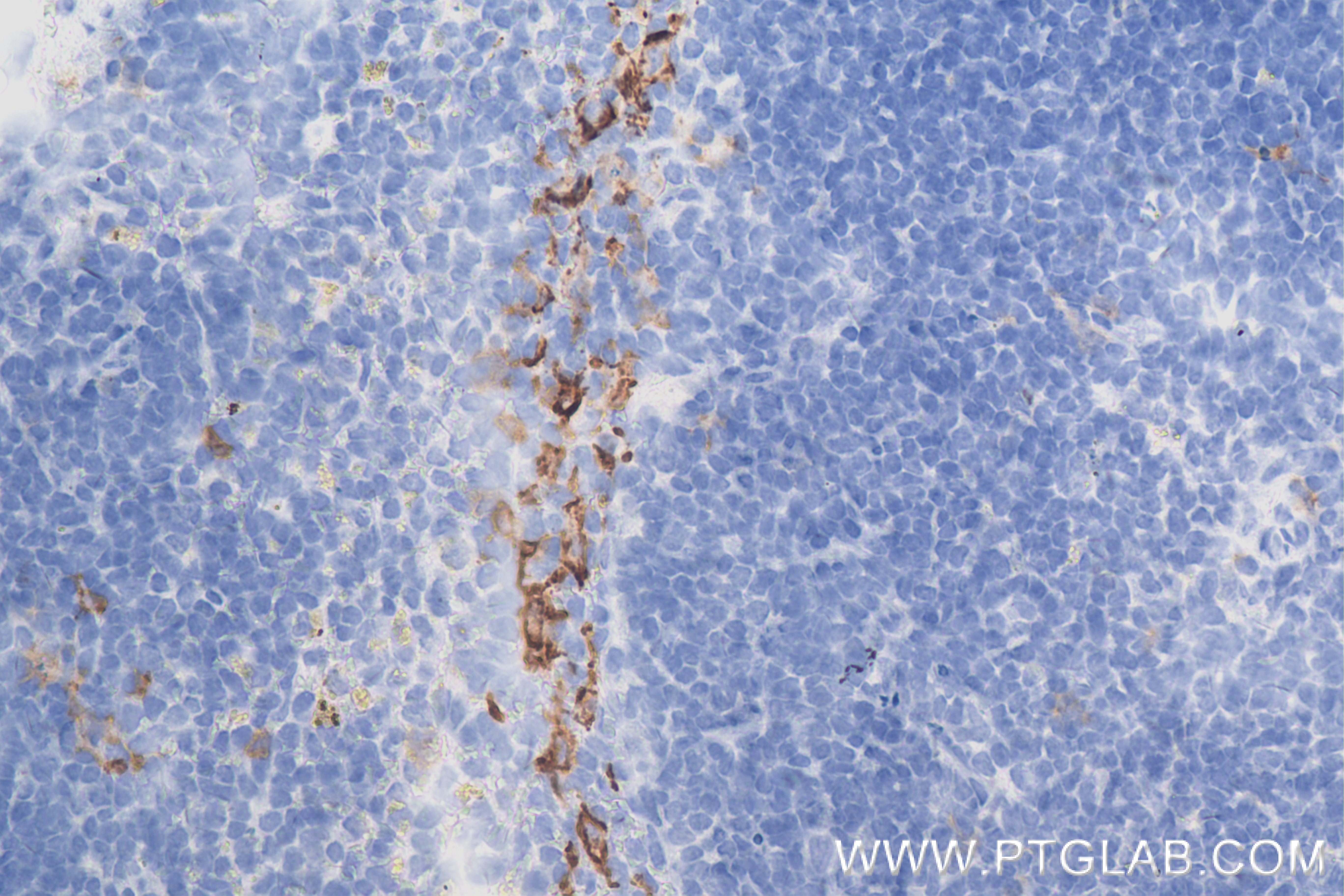 IHC staining of mouse spleen using 84365-5-RR