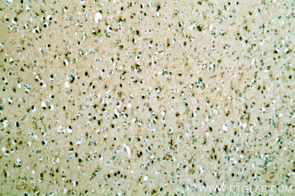 IHC staining of human brain using 17825-1-AP