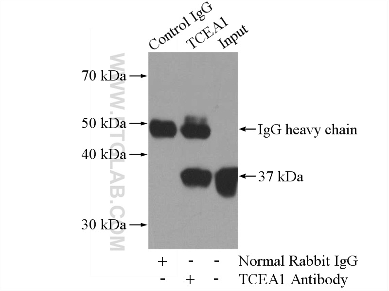 IP experiment of HeLa using 17825-1-AP