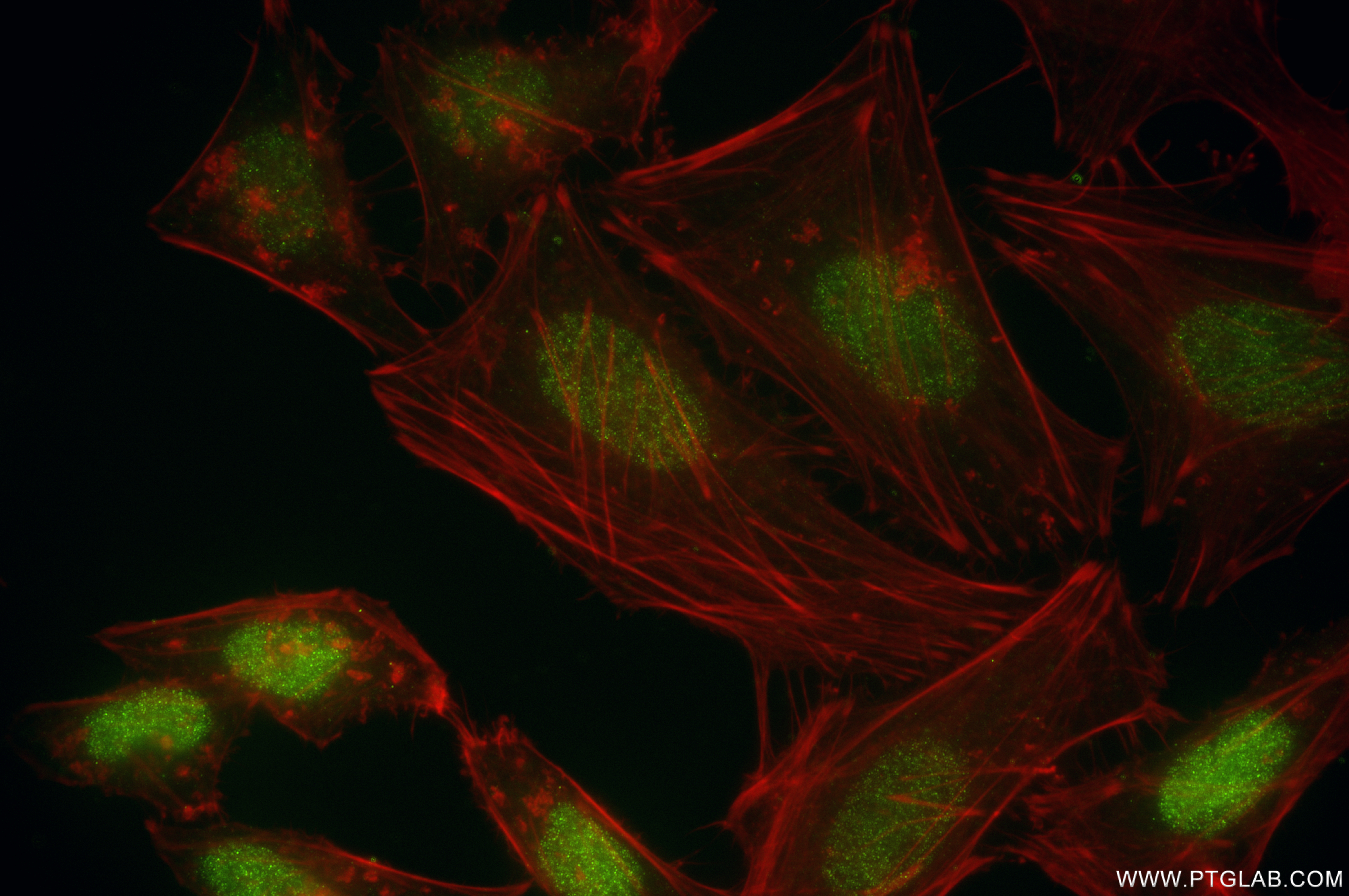 IF Staining of HeLa using 85664-4-RR
