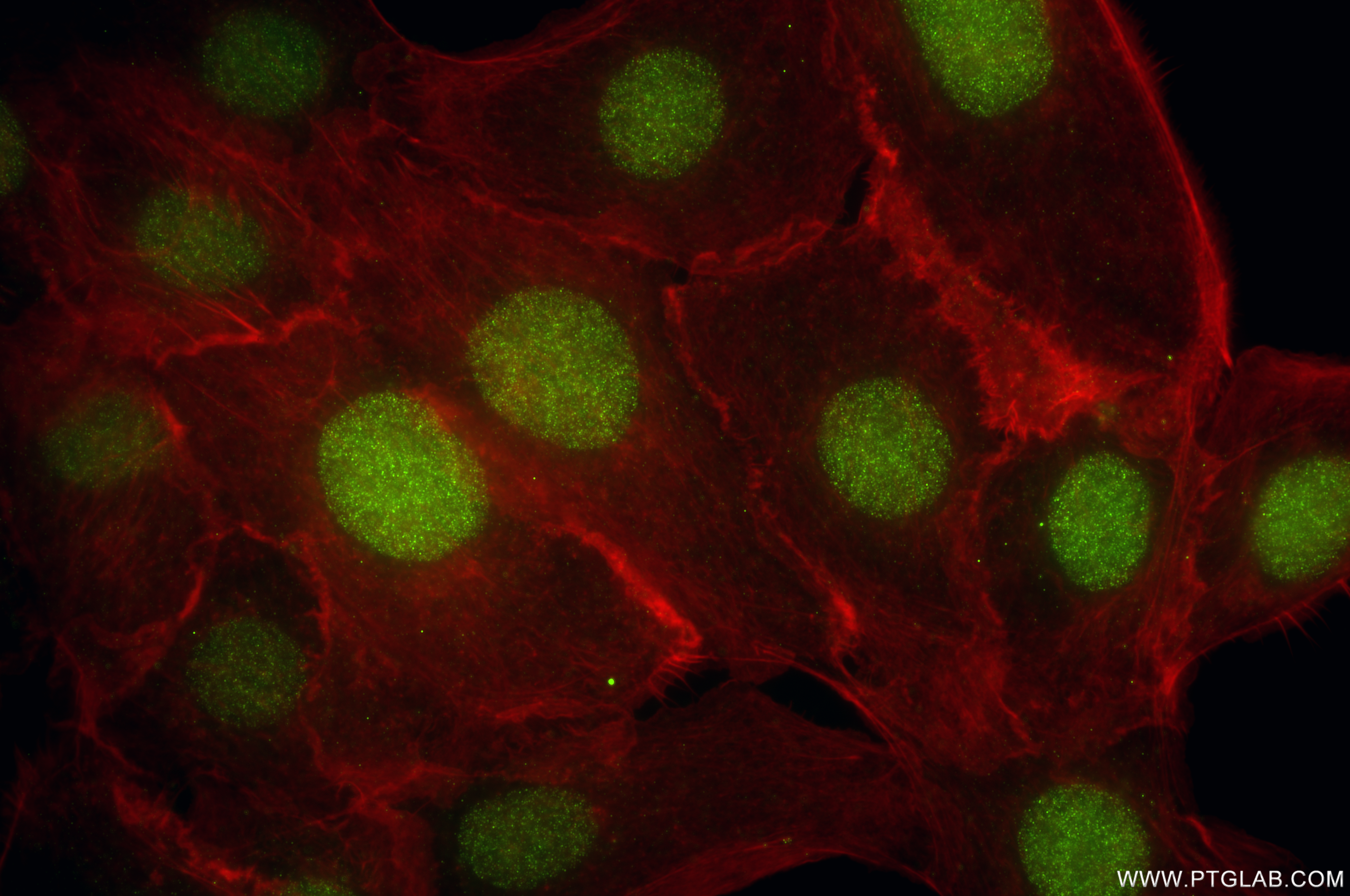 IF Staining of A431 using 85664-4-RR