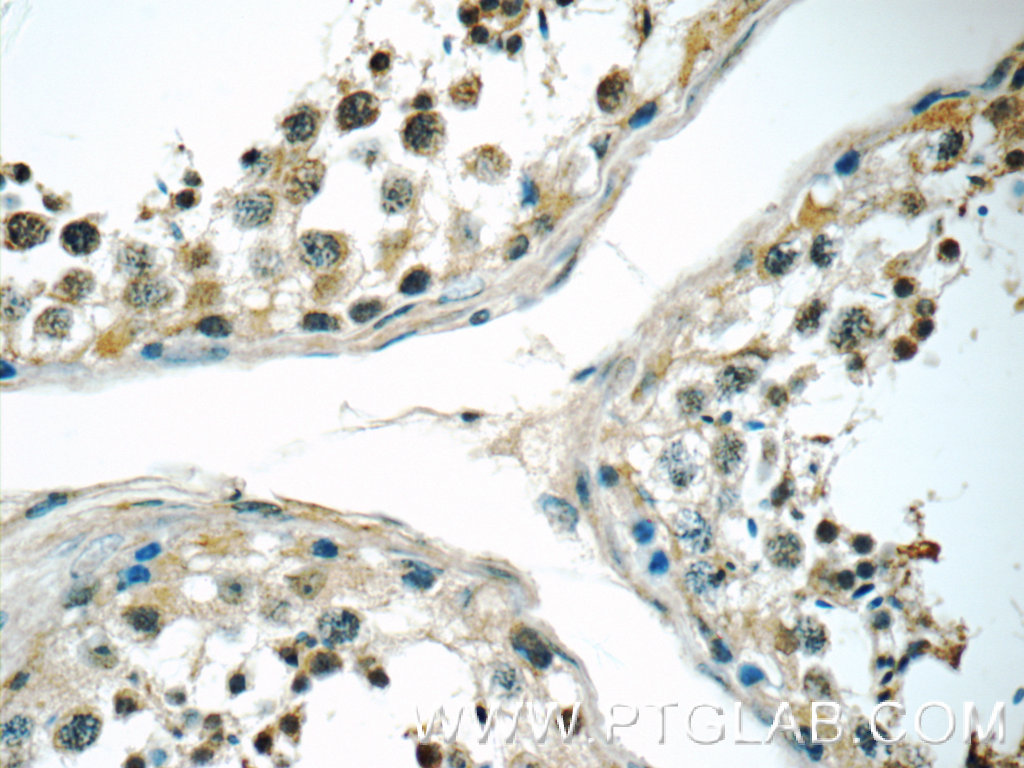 IHC staining of human testis using 17370-1-AP