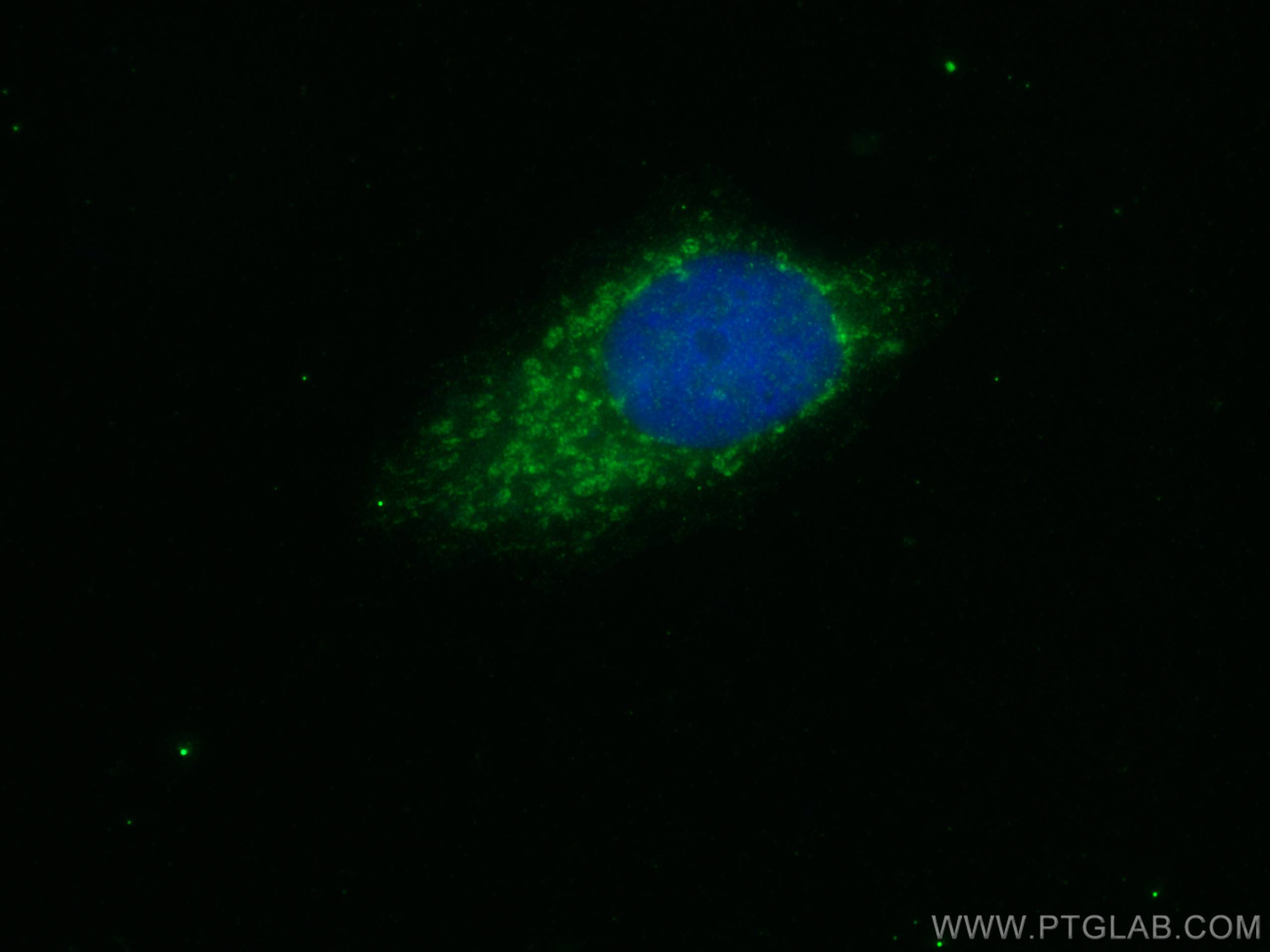 IF Staining of MCF-7 using 51045-1-AP