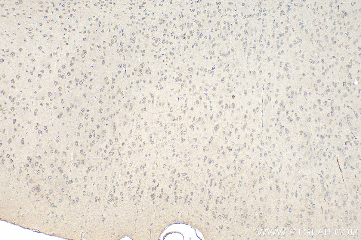 IHC staining of mouse brain using 51045-1-AP