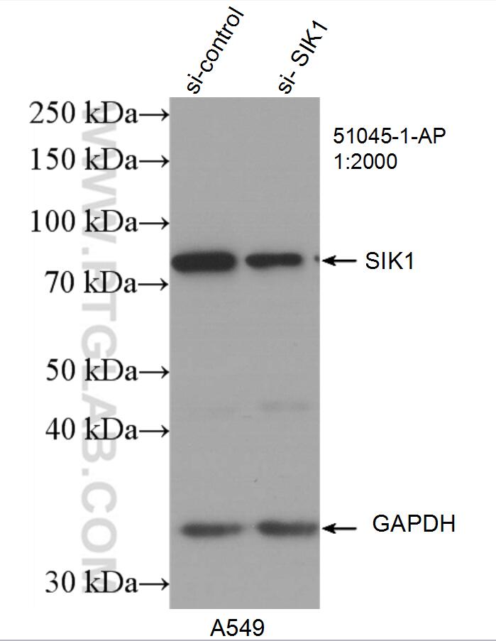 WB analysis of A549 using 51045-1-AP