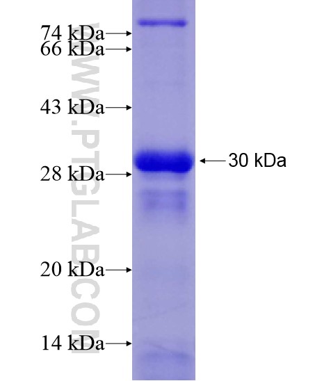 SIK1 fusion protein Ag28491 SDS-PAGE SIK1 fusion protein Ag28491 SDS-PAGE
