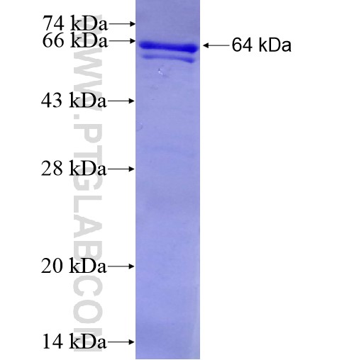 SIK1 fusion protein Ag10984 SDS-PAGE SIK1 fusion protein Ag10984 SDS-PAGE