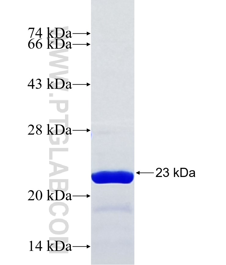 SIK2 fusion protein Ag38348 SDS-PAGE