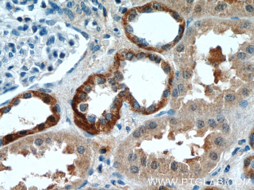 IHC staining of human kidney using 24110-1-AP