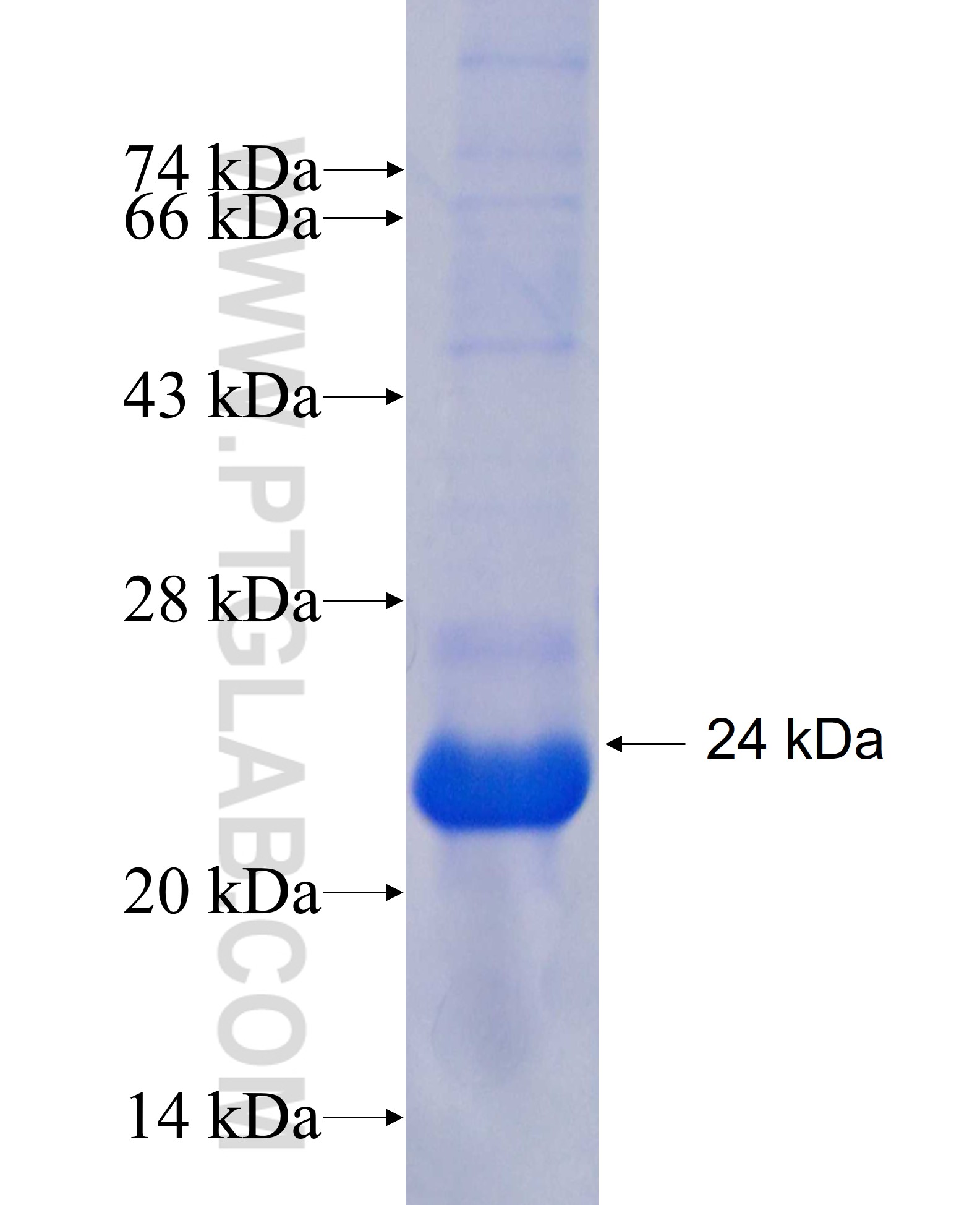 SILV fusion protein Ag25802 SDS-PAGE
