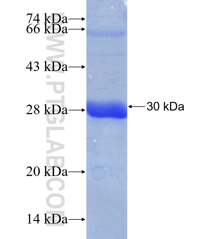 SIM2 fusion protein Ag31170 SDS-PAGE