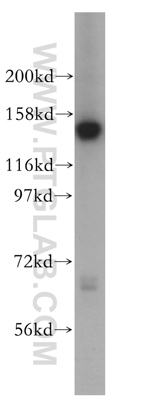 SIN3A Polyclonal antibody