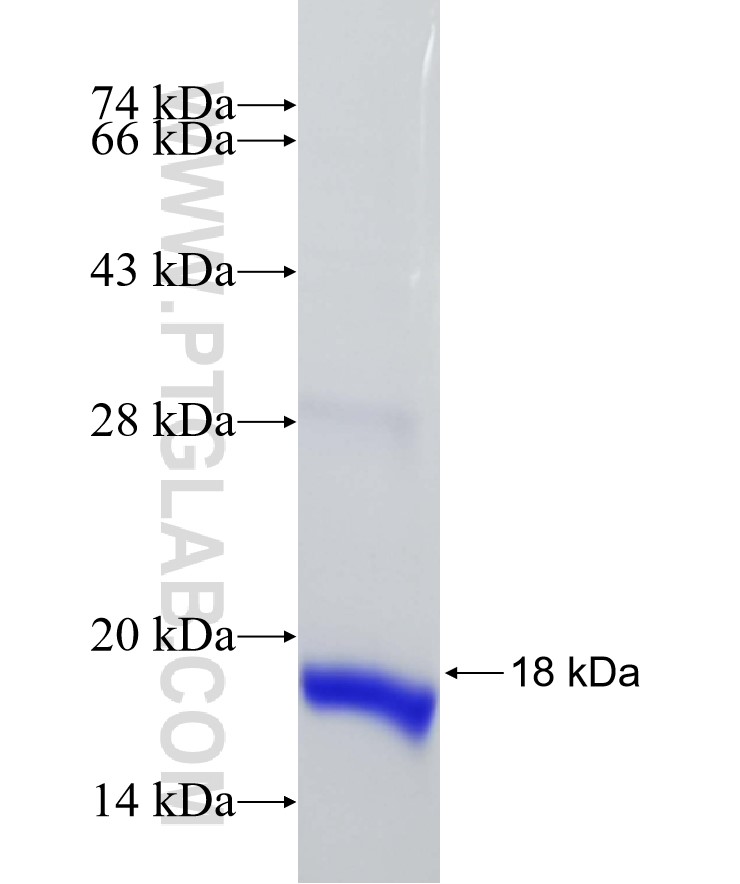 SIN3B fusion protein Ag26798 SDS-PAGE SIN3B fusion protein Ag26798 SDS-PAGE