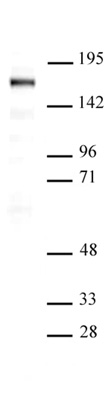 SIP1 antibody (mAb) tested by Western blot. Detection of SIP1 by Western blot. The analysis was performed using 20 ug of Saos-2 nuclear cell extract and SIP1 (mAb) at a 1 ug/ml dilution.