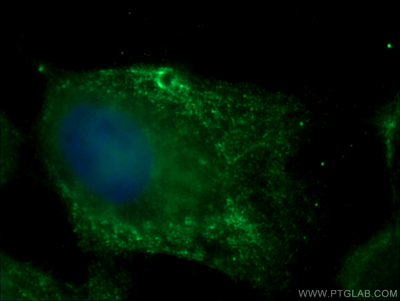 IF Staining of A431 using 26793-1-AP