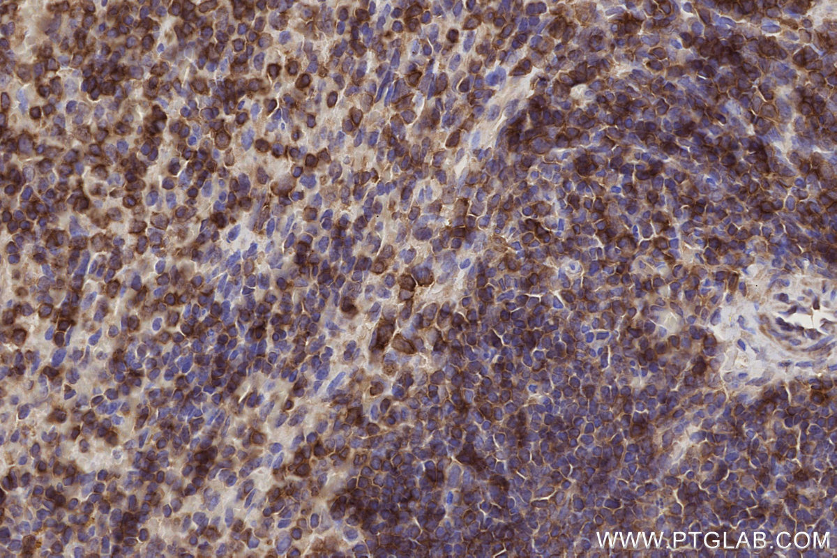 IHC staining of mouse spleen using 26793-1-AP