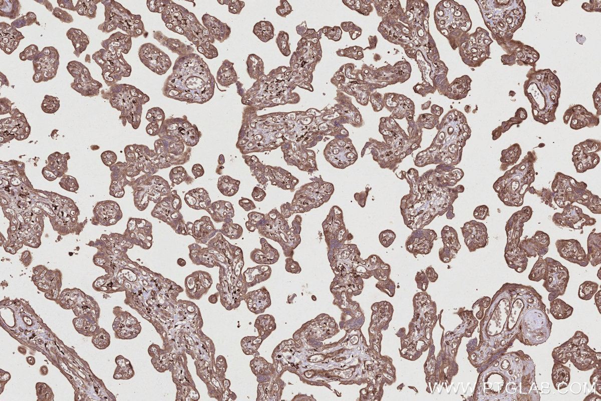 IHC staining of human placenta using 26793-1-AP