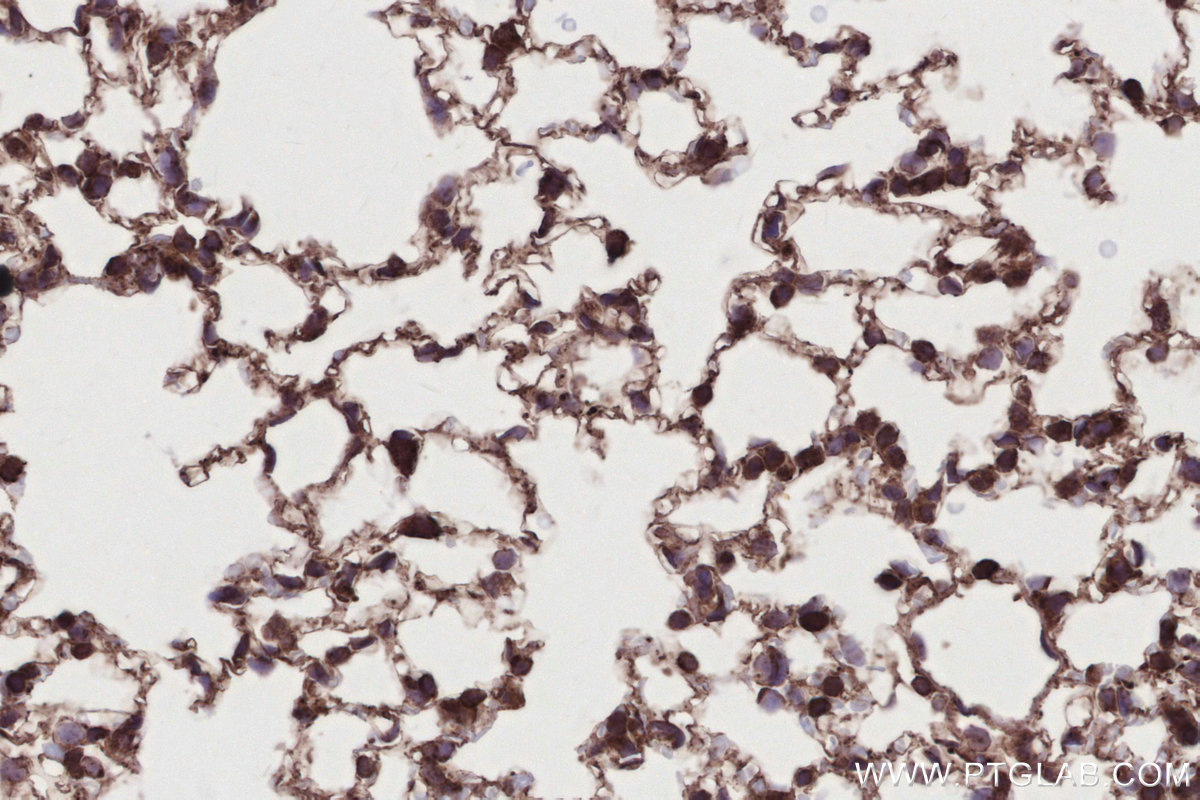 IHC staining of mouse lung using 26793-1-AP IHC staining of mouse lung using 26793-1-AP