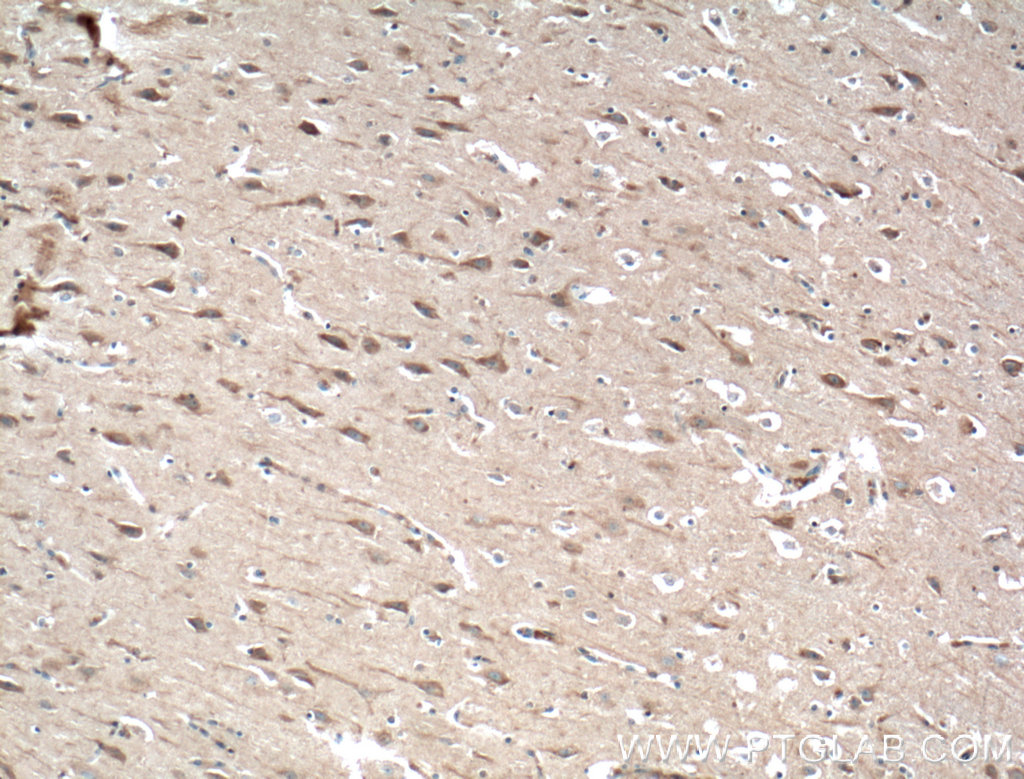 IHC staining of human brain using 25086-1-AP (same clone as 25086-1-PBS)