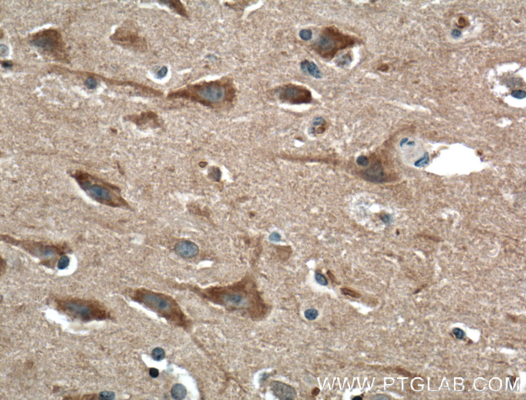 IHC staining of human brain using 25086-1-AP (same clone as 25086-1-PBS)
