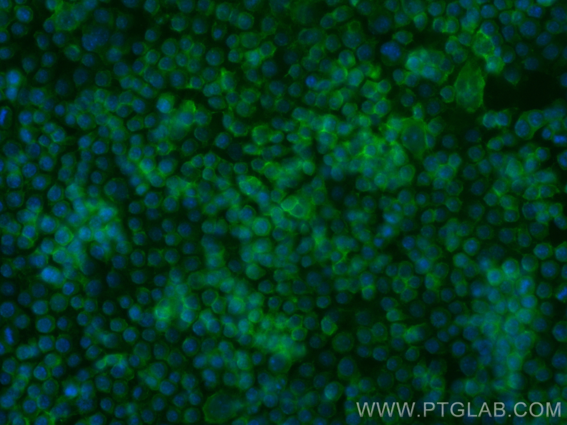 IF Staining of RAW 264.7 using CL488-84430-2