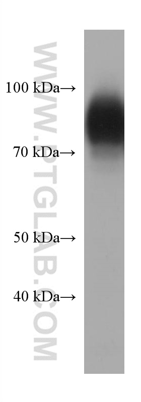 SIRP Alpha/CD172a