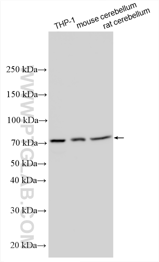 Various lysates were subjected to SDS PAGE followed by western blot with 14482-1-AP (SIRP Alpha/CD172a antibody) at dilution of 1:1000 incubated at room temperature for 1.5 hours. WB analysis using 14482-1-AP