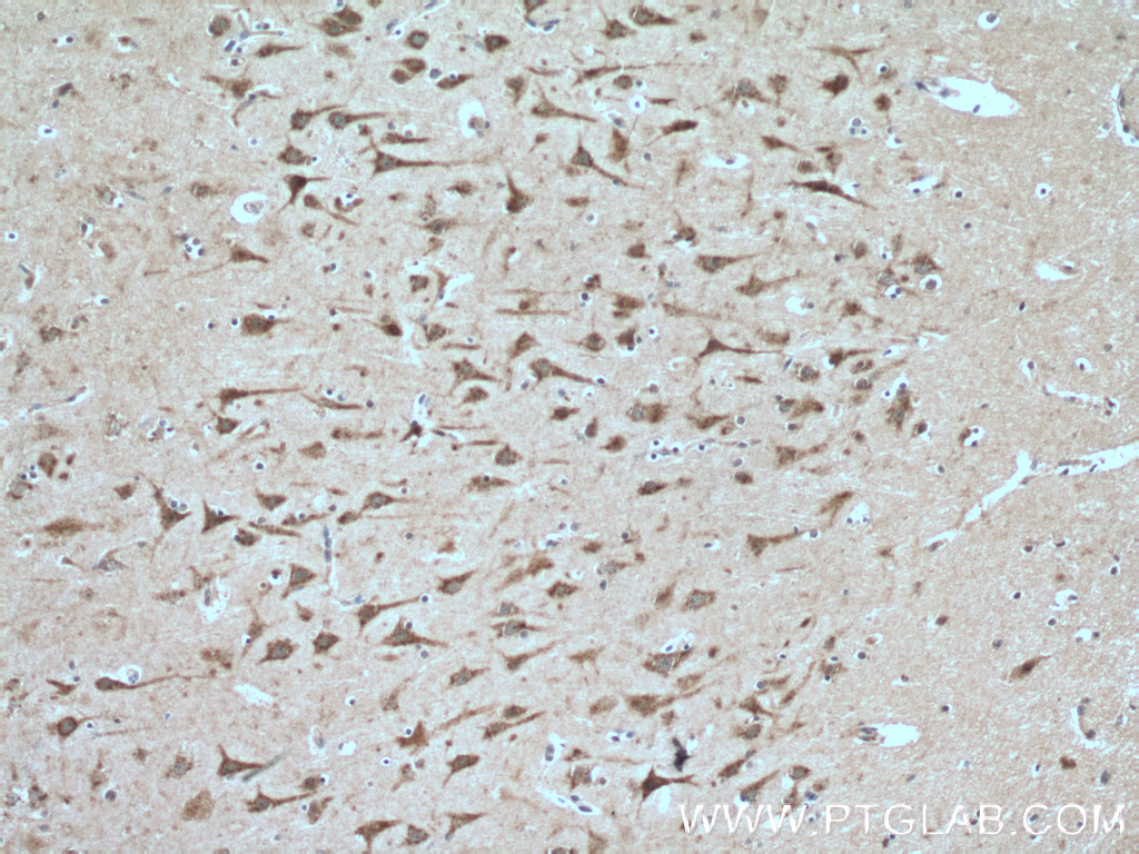 IHC staining of human brain using 26594-1-AP