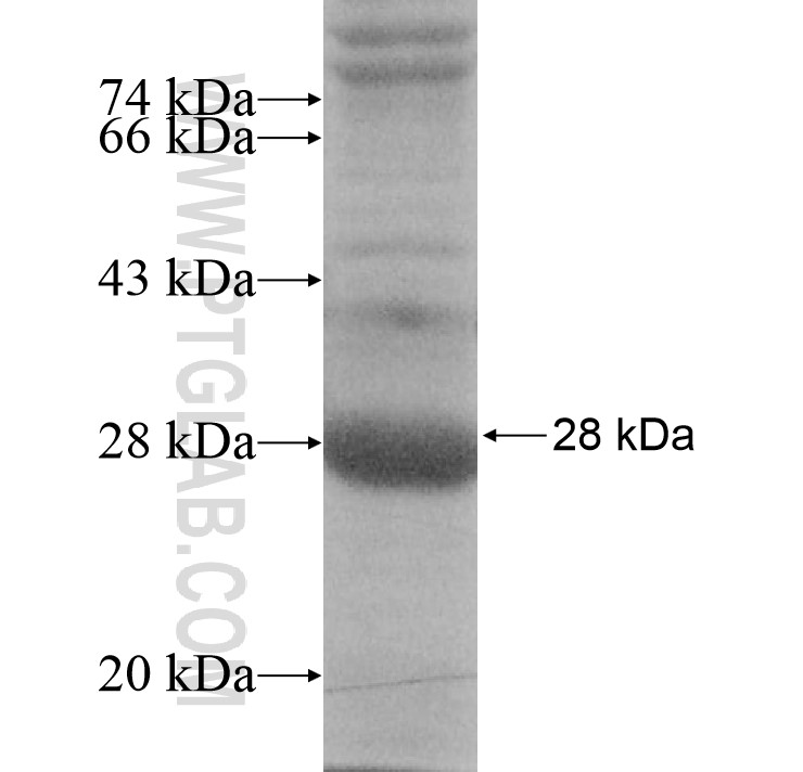 SIRPD fusion protein Ag15431 SDS-PAGE SIRPD fusion protein Ag15431 SDS-PAGE