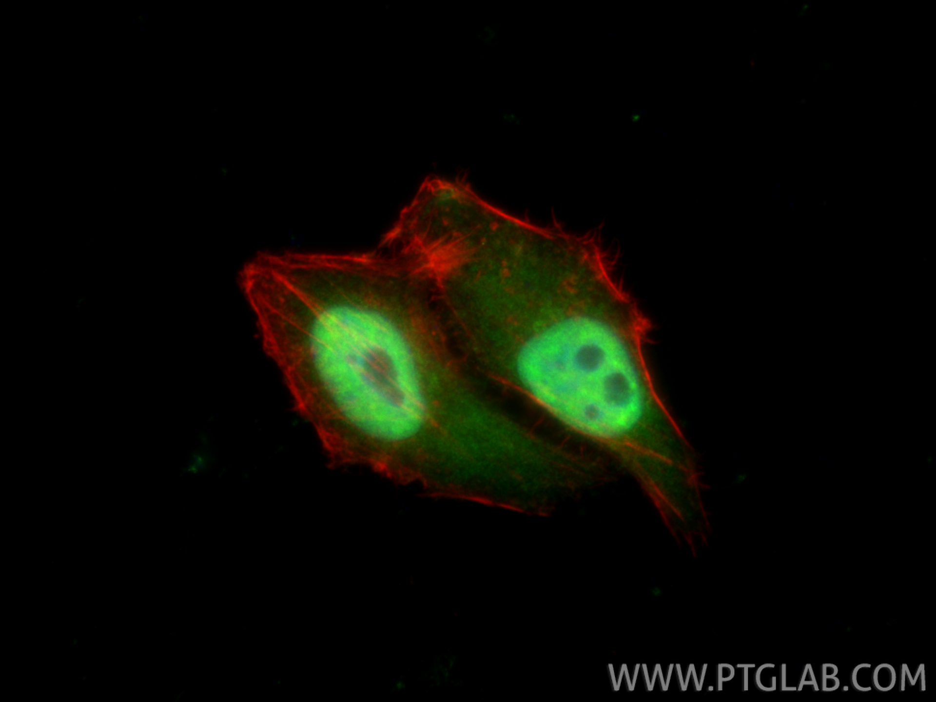 IF Staining of HepG2 using 13161-1-AP