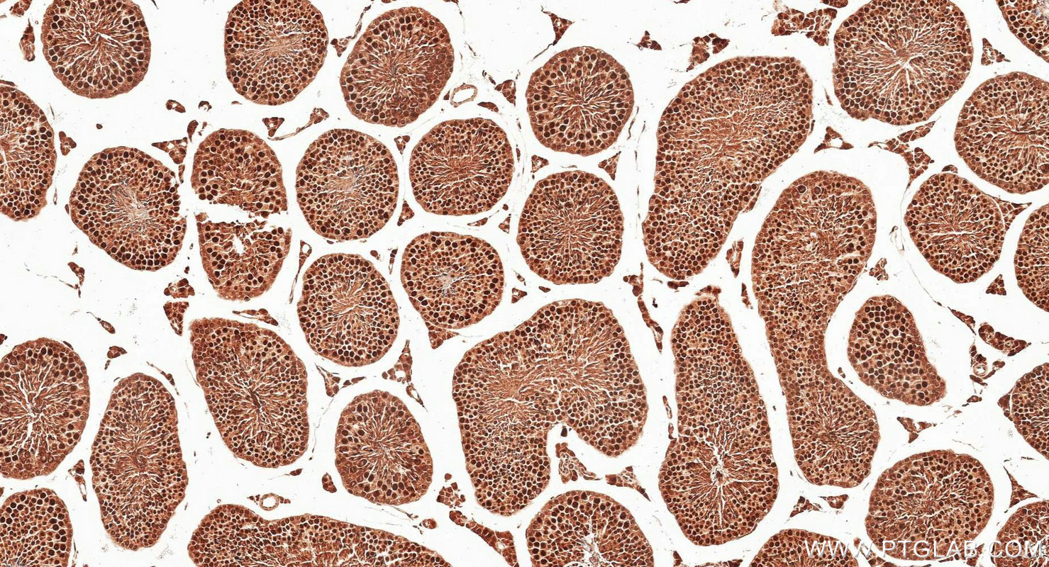 IHC staining of mouse testis using 13161-1-AP